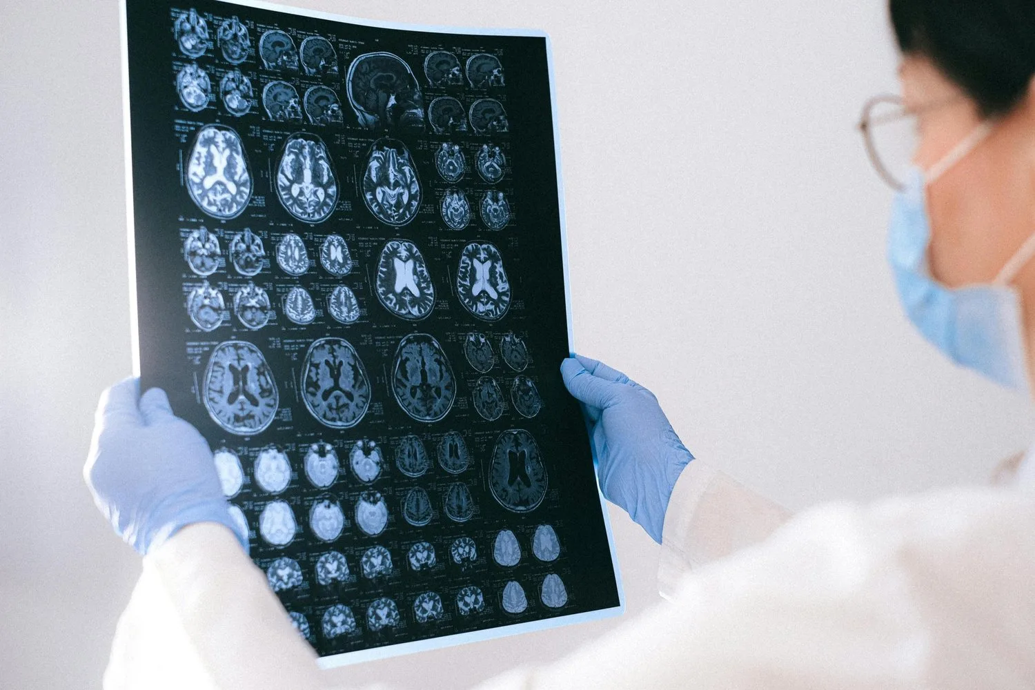 A masked, gloved clinician holds up a brain MRI scan printout.